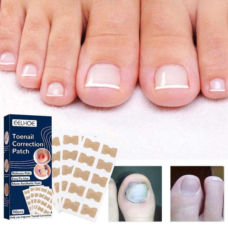 NagelPatches™ | Gesso corretivo para unhas bonitas e saudáveis